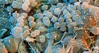 Патогенные бактерии в полости рта